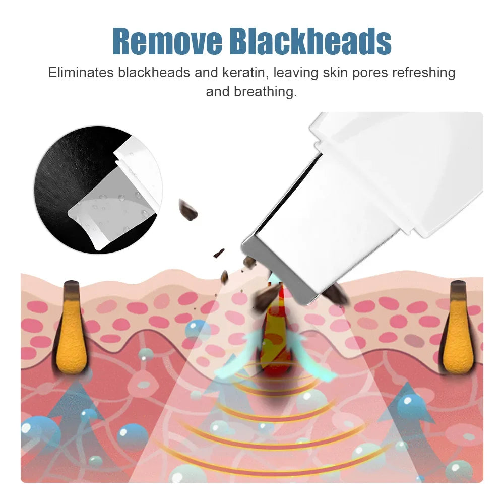 Ultrasonic Skin Scrubber Blackhead Remover