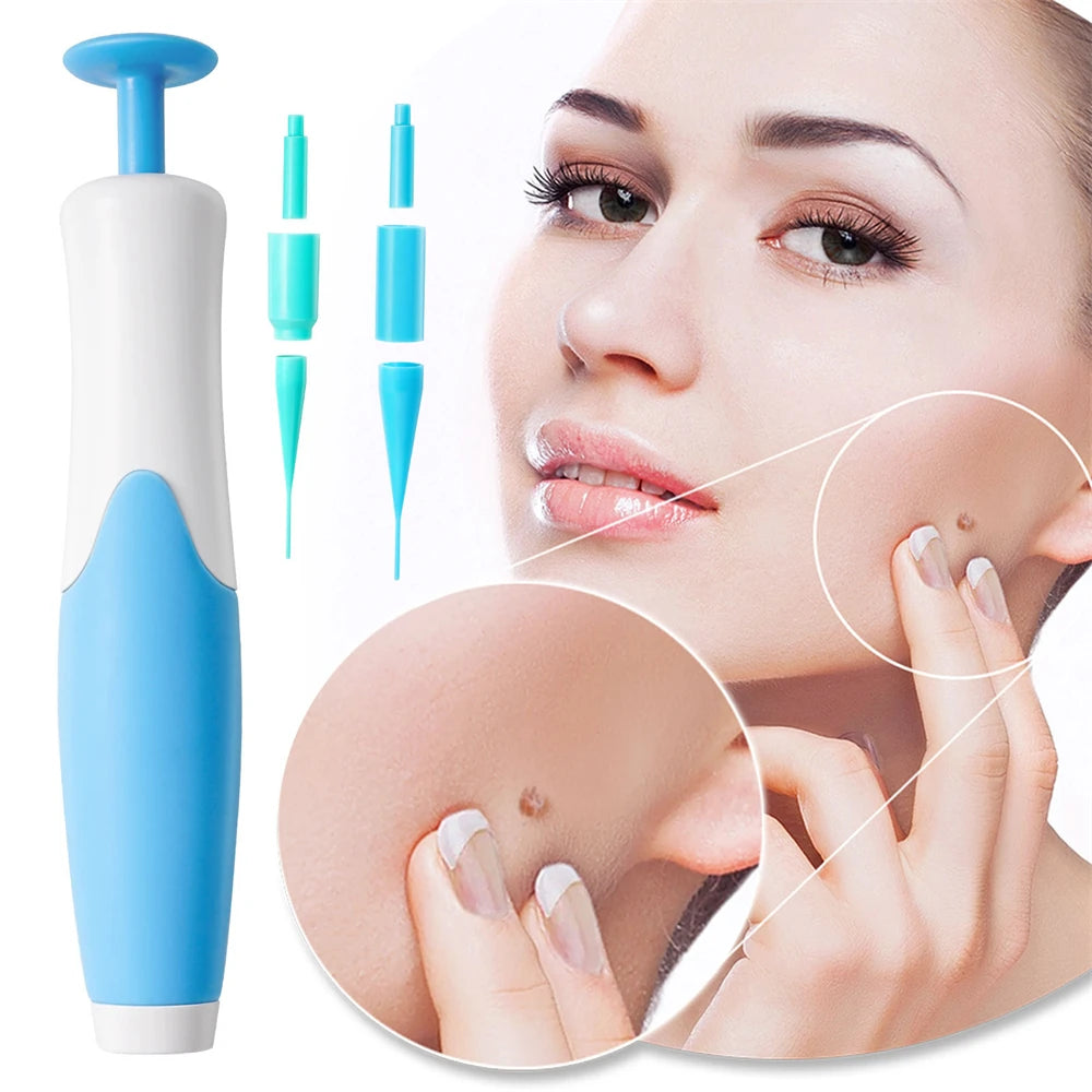 Painless Skin Tag  Removal Kit