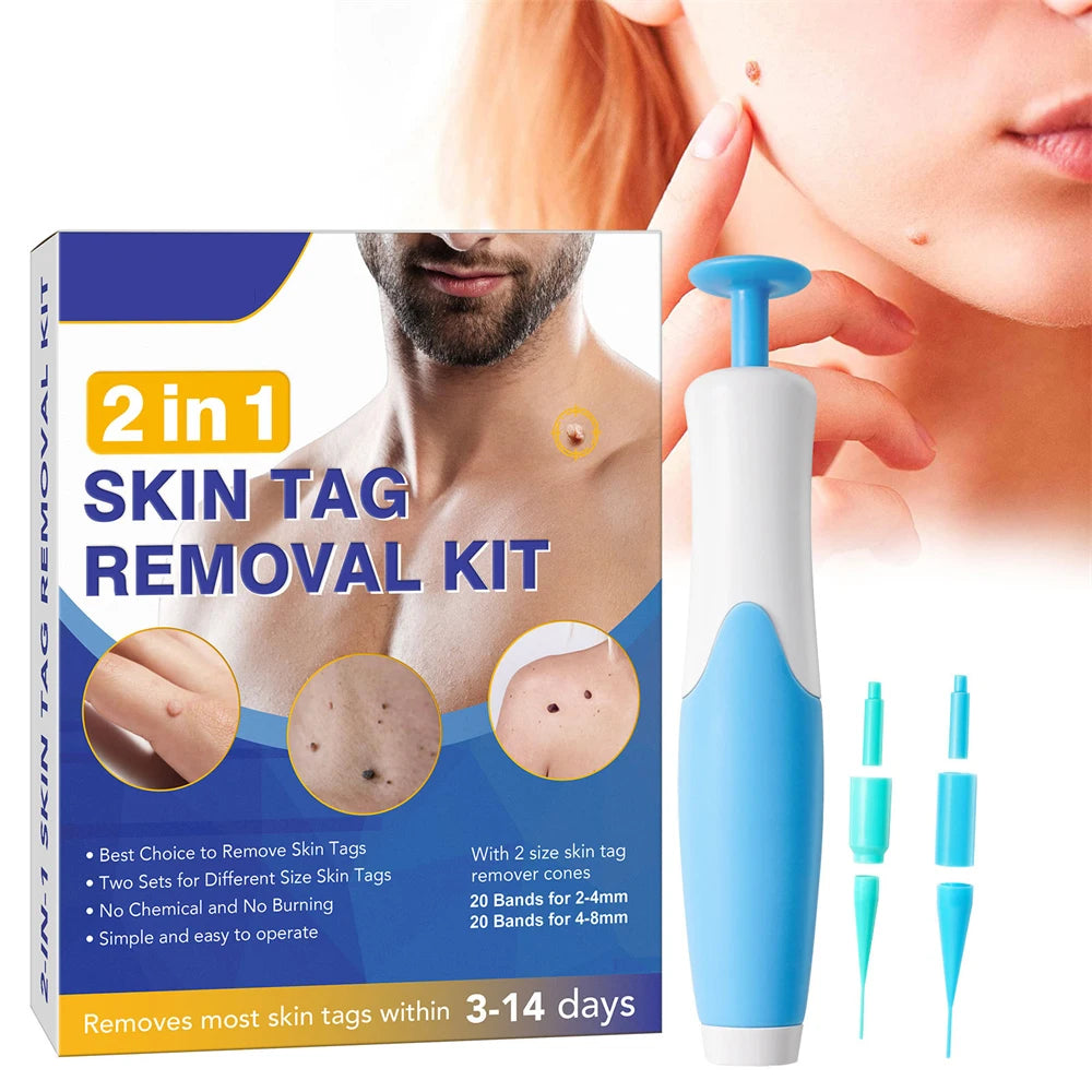 Painless Skin Tag  Removal Kit
